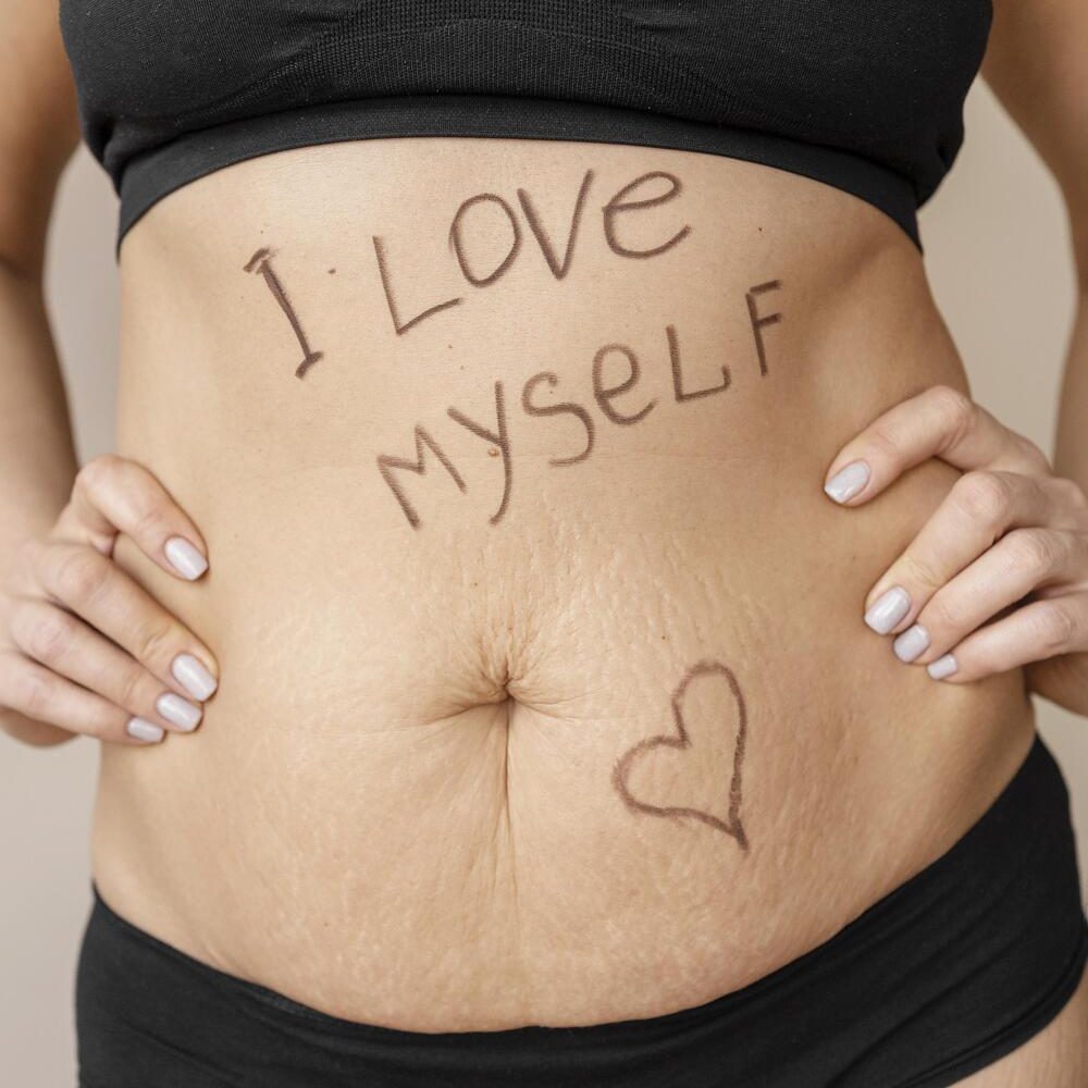 Diástasis abdominal